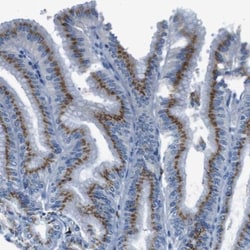 SLC35A3 Antibody, Novus Biologicals 25 &mu;L; Unlabeled:Antibodies, Polyclonal